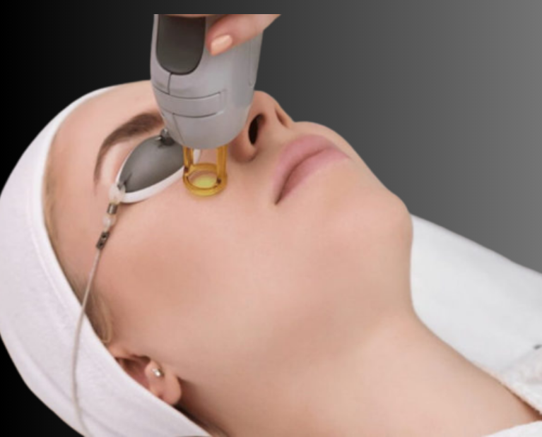 Laser treatment in Guntur - Leelavathi Skin & Laser Centre