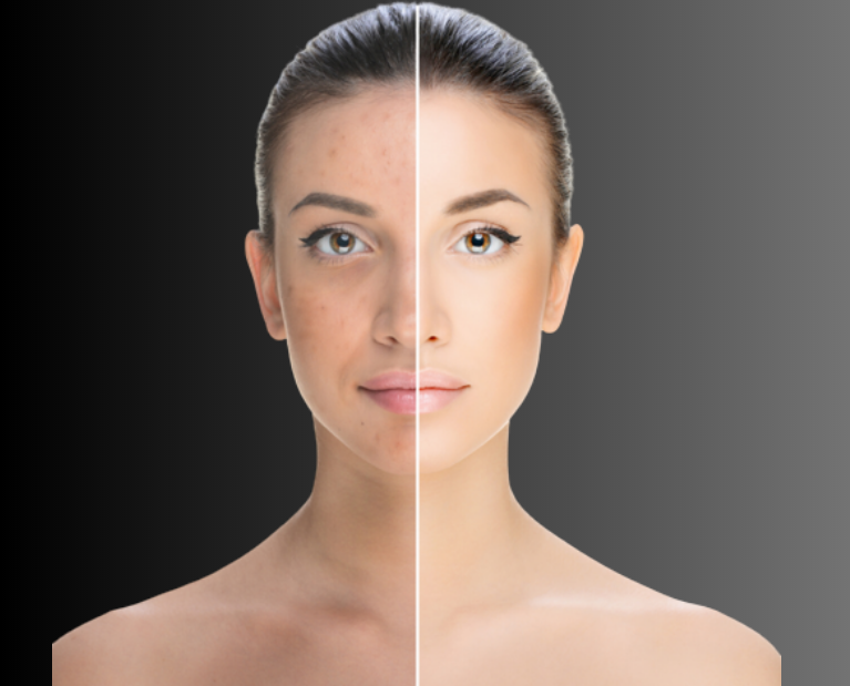 Dull skin and pigmentation treatment in Guntur