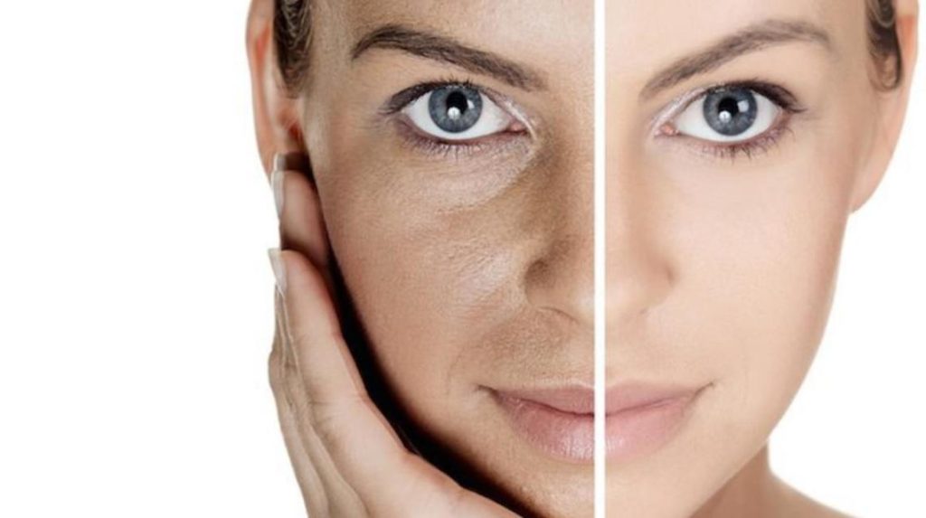 Dull Skin Treatment in guntur