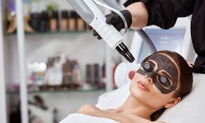 Carbon Laser Facial Treatment in Guntur