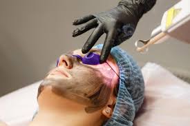 Carbon Laser Facial Treatment in Guntur